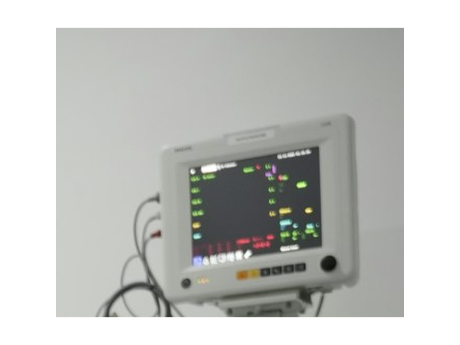 Mindray Monitor