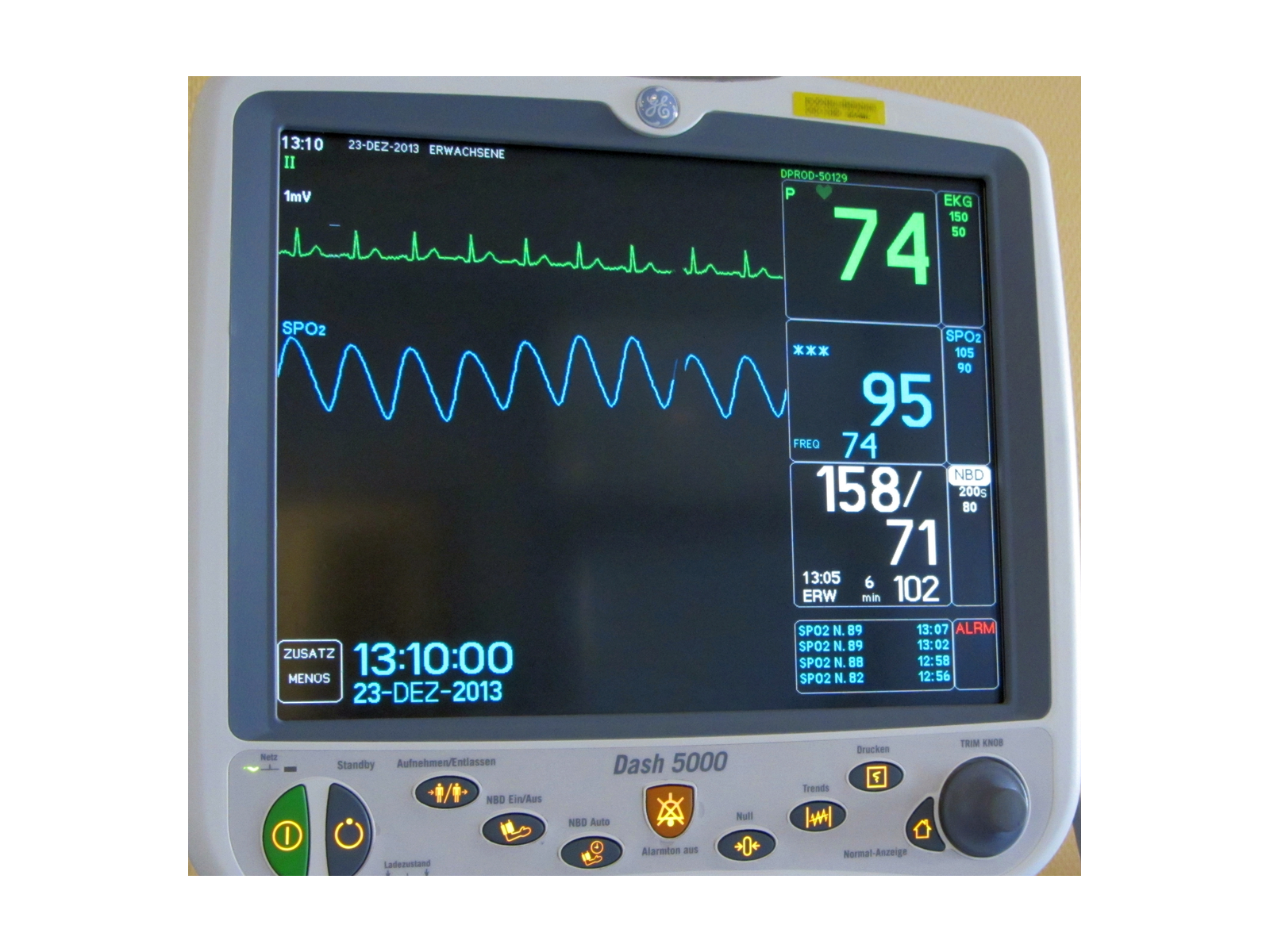 Patient Monitor