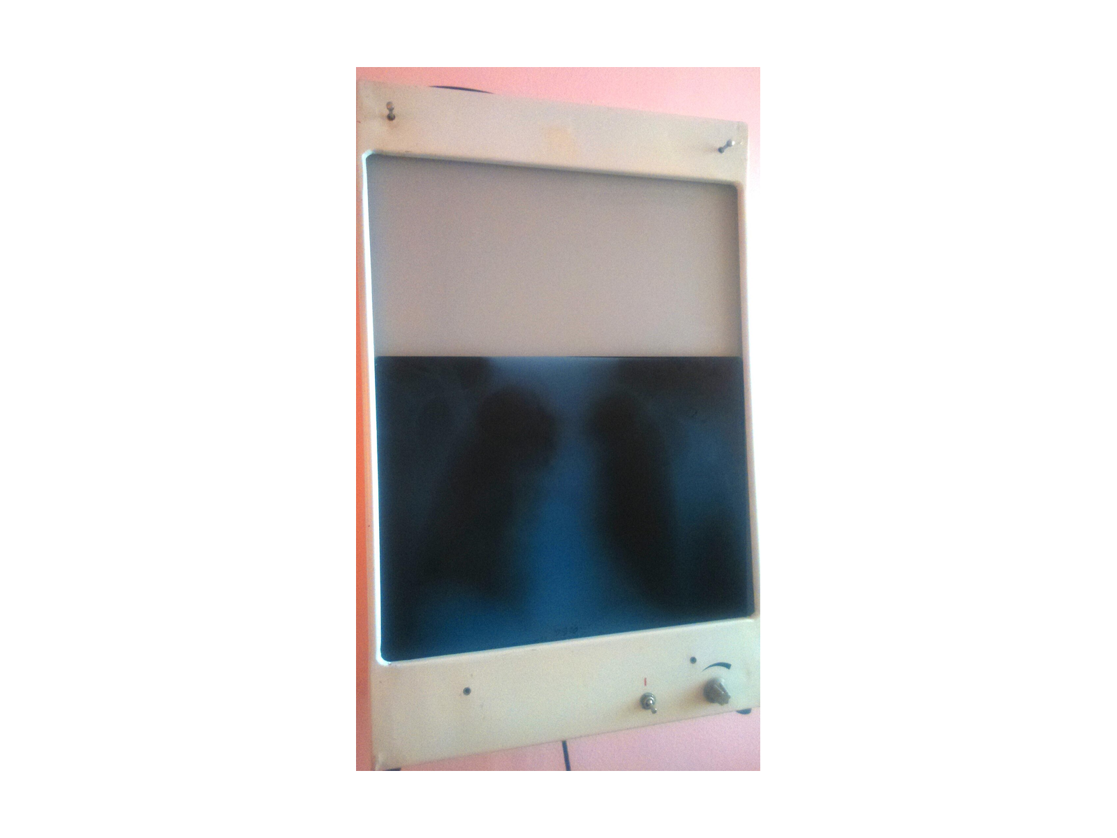 X-Ray Film Viewer